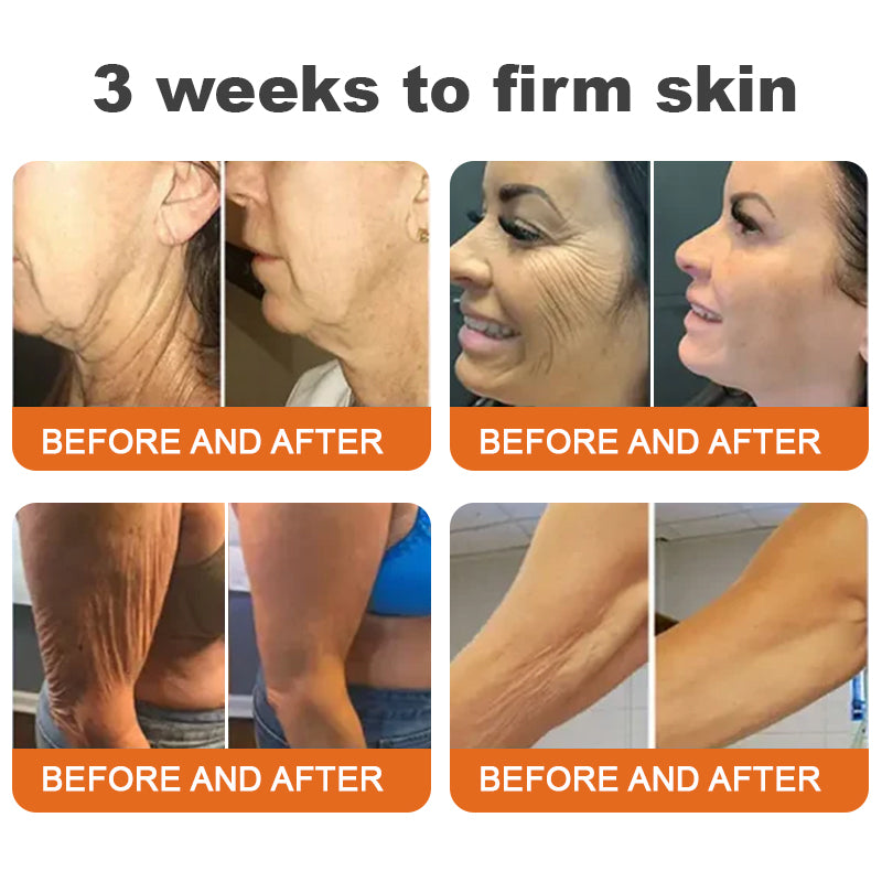 💫Made and Shipped from AU🇦🇺Rolimey® Botox Bee Venom Firming Serum Stick(⏳LAST DAY 70% OFF)✨
