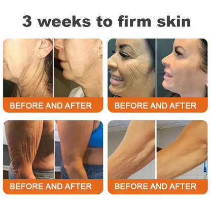 💫Made and Shipped from AU🇦🇺Rolimey® Botox Bee Venom Firming Serum Stick(⏳LAST DAY 70% OFF)✨